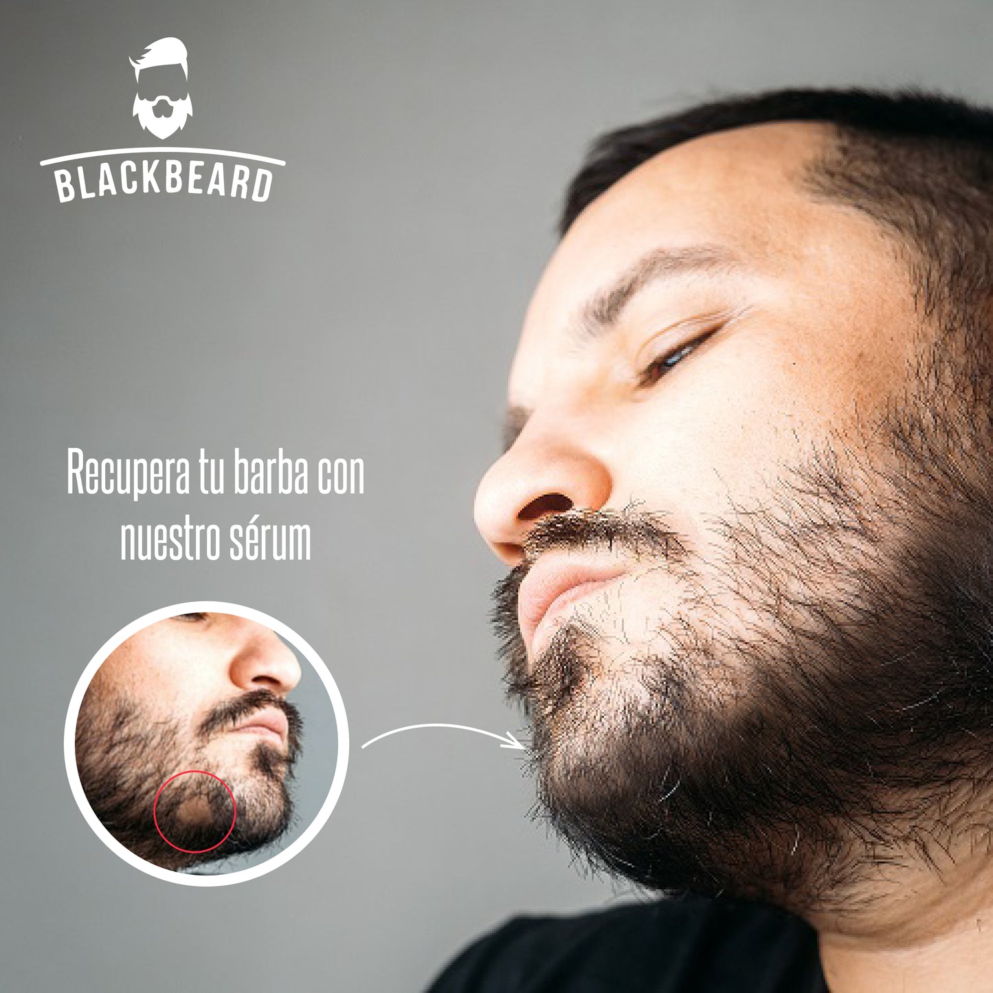Minoxidil Al 15% Roll On Bizarra Negra para barba y cabello 1 Pieza