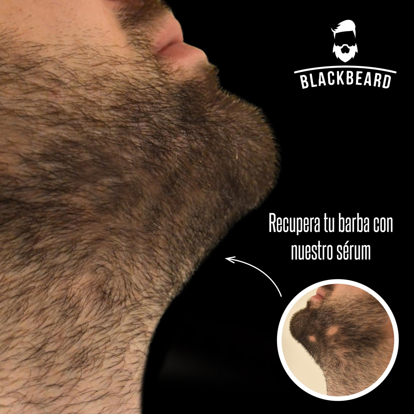 Minoxidil al 10% en roll-on 1 pieza