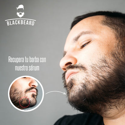 Minoxidil al 5% en spray 1 pieza