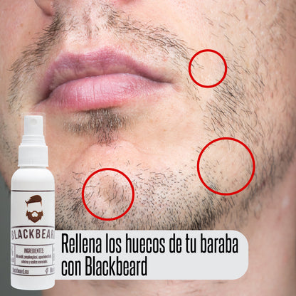 Minoxidil al 5% en spray 1 pieza