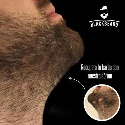 Minoxidil Al 15% + Aplicador Blackbeard Cafeína 2 piezas